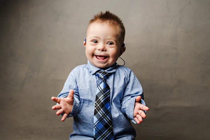 Picture of a little boy with downs syndrome.